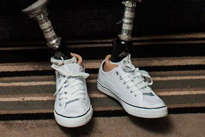 Po cezario pjūvio pabudusi moteris tokios baigties nesitikėjo