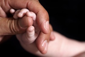 Keistas sutrikimas: metų kūdikis it 25-erių vyras