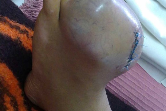 Nesirūpino sveikata ir štai kuo baigėsi. Nuotraukos šokiruoja