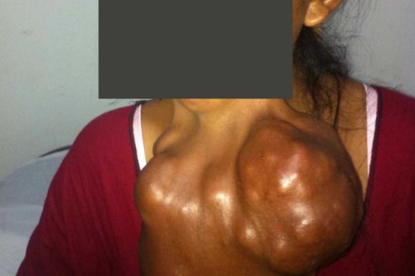 Kaklo auglys<br>„Figure1“ nuotr.