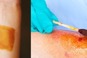 Atlikite šį testą, štai ką rezultatas parodys apie sveikatą