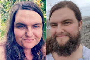 Barzdą auginanti moteris jaučiasi gundanti ir seksuali