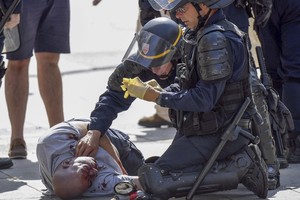 Sužvėrėję chuliganai gatvėse? Rusijos politikas problemos nemato