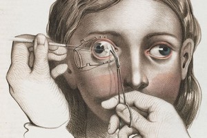 Šie piešiniai atskleis, kodėl nenorėtumėte gyventi viduramžiais