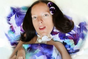 Jauna kaunietė 11 metų gyvena lovoje: „Nieko nenorėčiau keisti“