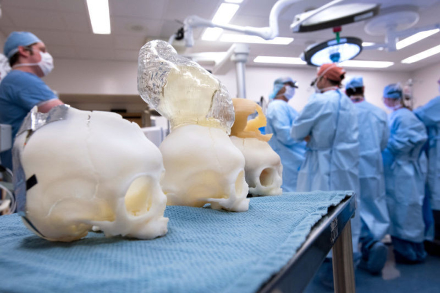 Gydytojai operaciją atlikti treniravosi naudodamiesi tiksliais Bentley kaukolės modeliais, atliktais 3D spausdintuvu.<br>Katherine C. Cohen/Bostono vaikų ligoninės nuotr.