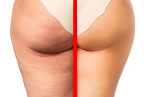 Viena paprasta gudrybė ir po pusvalandžio rezultatas nustebins