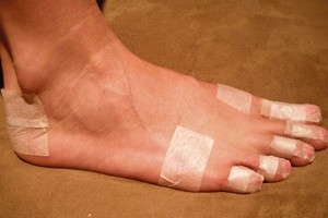 Batai nutrina kulnus? Šis pigus būdas nebeleis tam pasikartoti