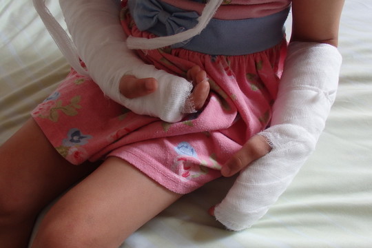 Vaikų darželyje 6-metę užgriuvo spinta: abi rankos – sugipsuotos