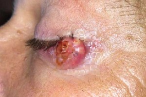 Toks pavojus gresia daugeliui, bet susimąsto – retas