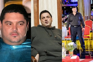 Stulbinantys humoristo Vitalijaus Cololo išvaizdos pokyčiai