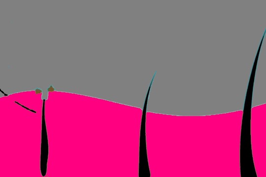 Sužinoję šią priežastį, nustosite pešioti plaukus iš nosies