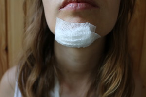 Kruviną mergaitę iškeikęs vairuotojas: „Aš ne žmogus“