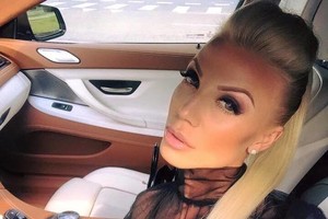 Marina Bui-Velečkienė atskleidė savo putlių lūpų paslaptį