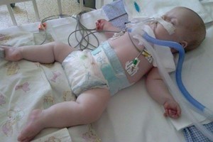 Pagimdžiusi nekvėpuojantį kūdikį, moteris iki šiol dėl jo kovoja