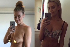 Lieknėjimo kaina: parodė, kaip atrodo atsikračiusi 90 kilogramų