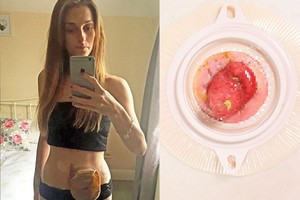 Pas medikus beldėsi dėl gerklės, baigėsi žiauriau, nei tikėjosi