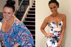 Per 9 mėnesius atsikratė 50 kilogramų. Chirurgų neprireikė