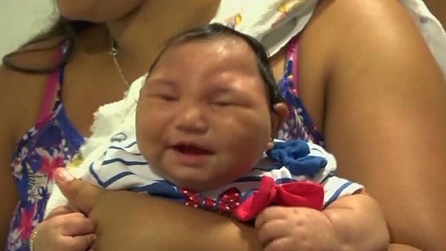 Europoje pagimdė pirmoji Zika virusu užsikrėtusi moteris
