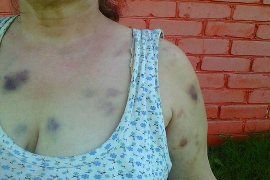 Karučiu vežtos sumuštos dzūkės istorijoje – nauji posūkiai