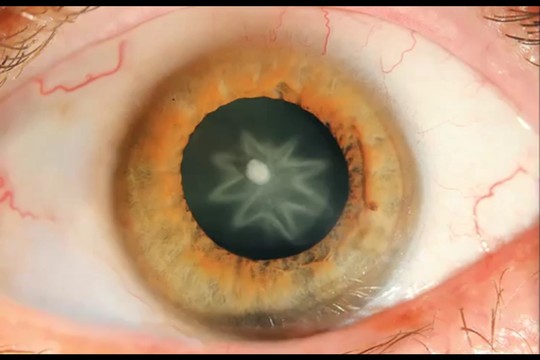 Nuo plaukuotų akių iki smegenų akmenų: 11 keisčiausių istorijų