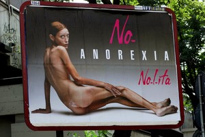 Šiurpi lemtis. Įžymybės, kurias anoreksija nuvarė į kapus