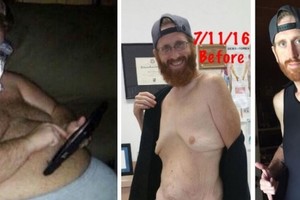 Neįtikėtinas vyro užsispyrimas pakeitė gyvenimą