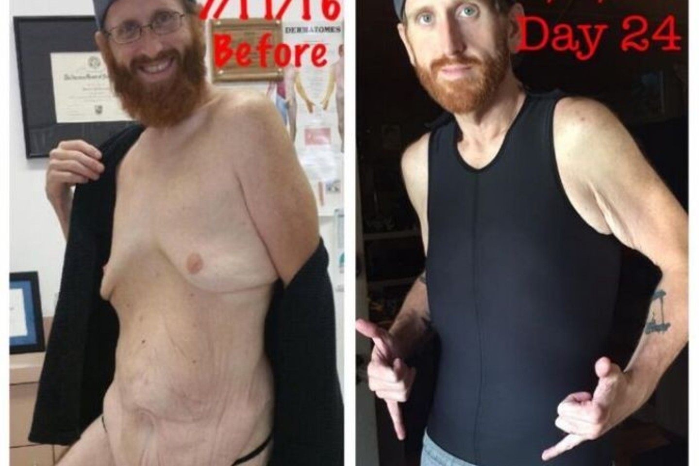 Beveik 70 atsikratytų kilogramų vyrą pakeitė neatpažįstamai.<br>Instagram.com nuotr.