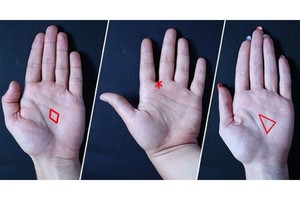 Turite delne trikampį, žvaigždę ar deimantą? Štai ką jie reiškia