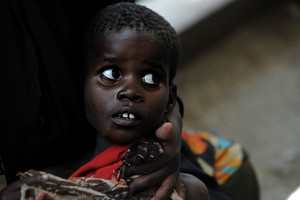 Centrinėje Afrikos Respublikoje – mirtinas choleros protrūkis