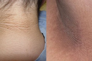 Turite tokių patamsėjimų? Štai kodėl privalote lėkti pas medikus