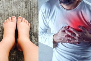 Sužinoję tai, įveiksite išsekimą, širdies problemas ir tinimus