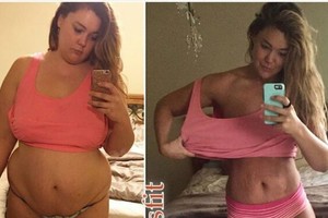 365 asmenukės išgelbėjo moters gyvybę ir sveikatą