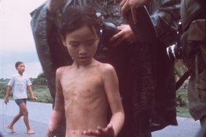 Šios vaikų nuotraukos šokiravo pasaulį