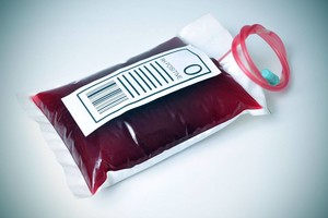 Kritiška padėtis: Nacionalinis kraujo centras šaukiasi pagalbos