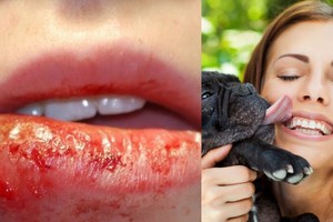 Dėl lemtingo „bučinio“ su augintiniu – pragaro kančios