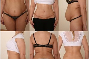 Kaunietei sportas nepadėjo, bet pasikeisti galop pavyko