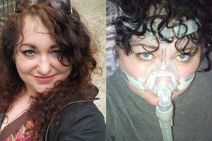 Paryžiuje gyvenanti lietuvė: „Kas naktį miegu su antsnukiu“