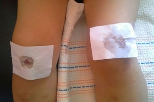 Darželyje suteikta pagalba sukrėtė motiną: „Negalėjau suvokti“