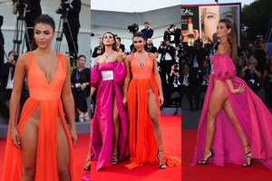 Persistengė: dvi manekenės ant raudono kilimo parodė ko nederėjo