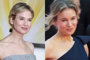 Kas nutiko aktorės Renee Zellweger veidui?