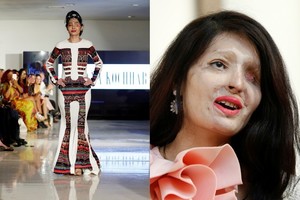 Niujorke ant podiumo pasirodė rūgšties sudarkyto veido modelis