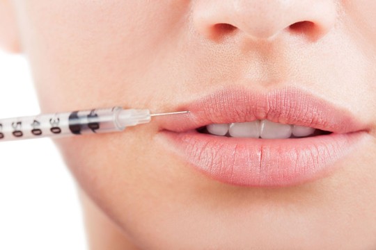 Mitai apie botulino toksiną, kuriuos paneigė dermatologė