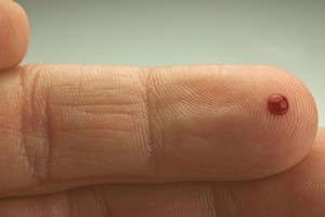 Ar susirgsite vėžiu, sužinosite iš visiems įprasto testo