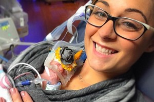 4 mėnesiais per anksti gimę dvynukai pranoko visus lūkesčius