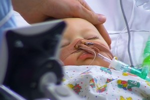 Tėvai vaiko mirtį leido transliuoti per televiziją dėl vienos priežasties