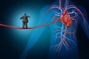 Šiuos infarkto požymius turėtų žinoti visi