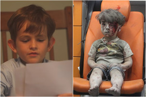 Šešiamečio pažadas kare sužalotam berniukui sujaudino pasaulį