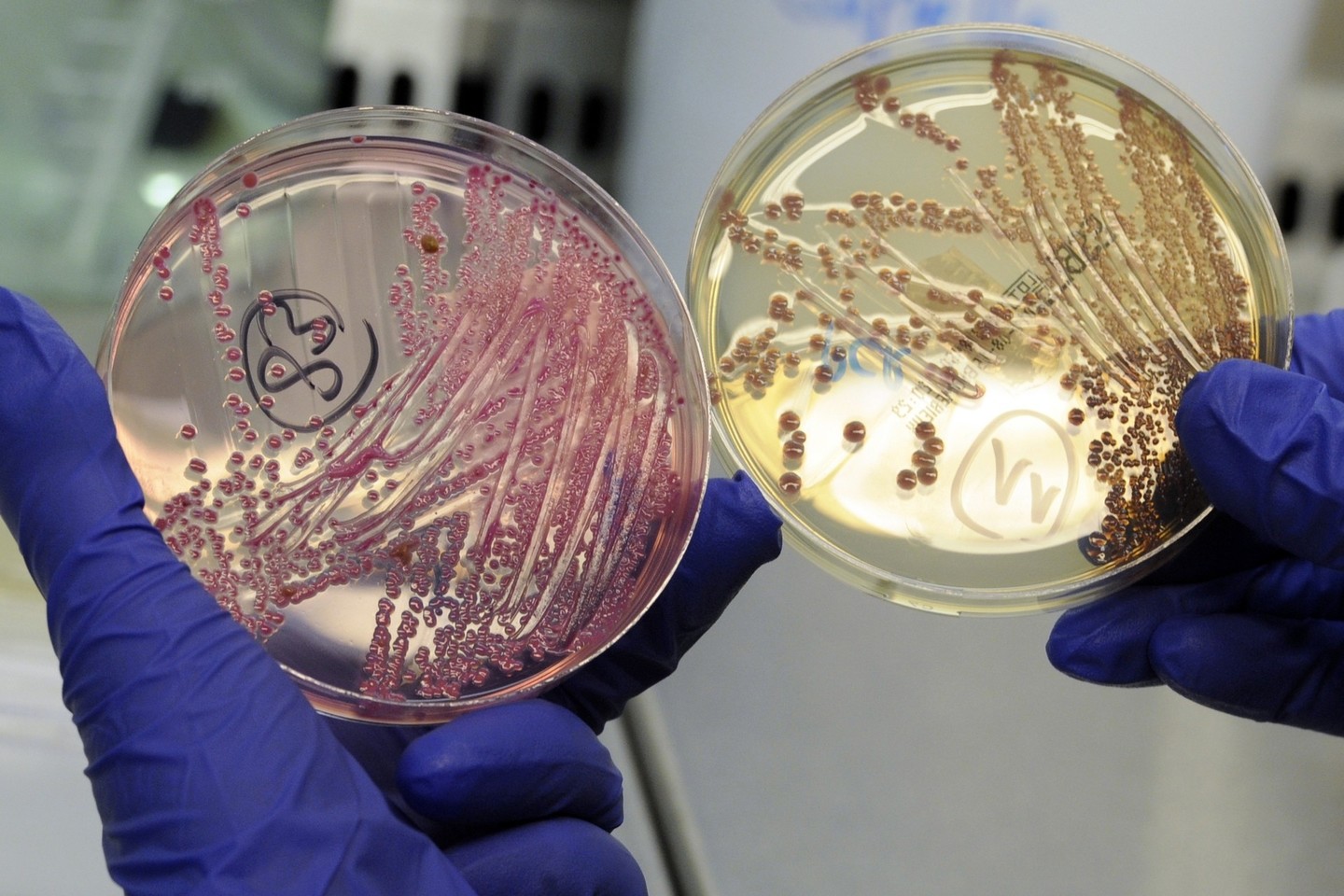 Mokslininkai tyrimus atliko su E.coli bakterijomis.<br>Reuters/Scanpix nuotr.