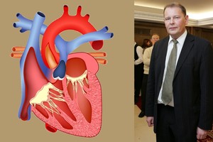 Profesorius perspėja – širdies ligos pasiekė epidemijos lygį